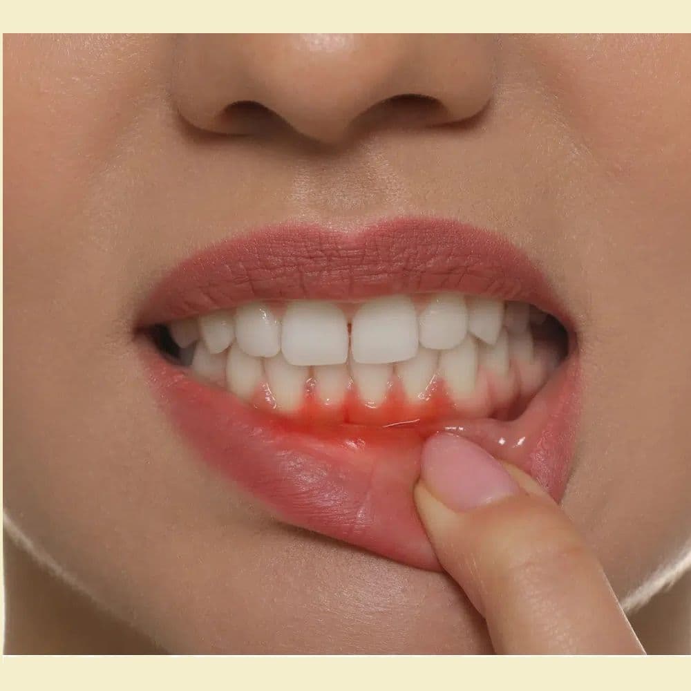 Gum Disease Treatment