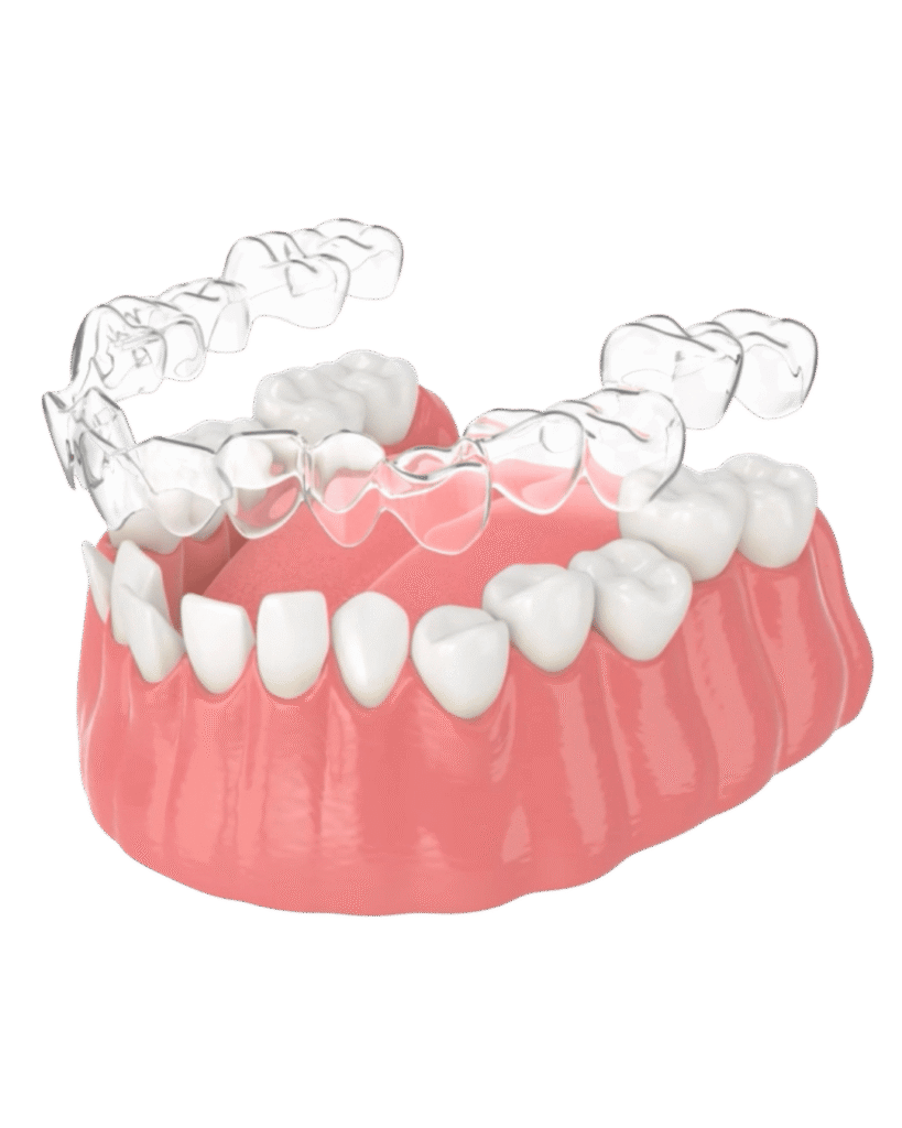 Aligner image